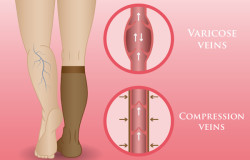 Medical Compression Hosiery